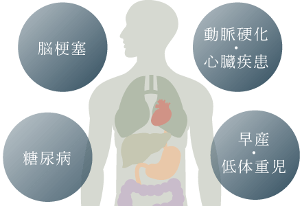 脳梗塞、動脈硬化、心臓疾患、糖尿病、早産、低体重児出産